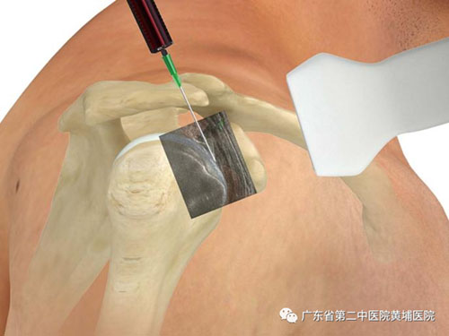 微信图片_20230505090304.jpg 微信图片_20230505090304.jpg